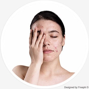 Akne- und Problemhautbehandlung