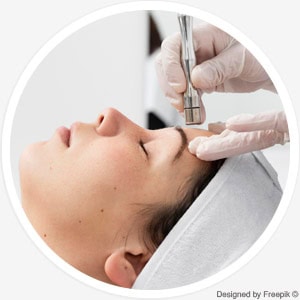 Diamant-Peeling Diamant-Peeling