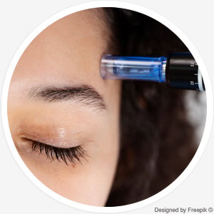Microneedling Microneedling