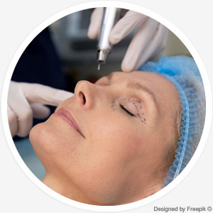 Plasma-Pen Therapie Plasma-Pen Therapie