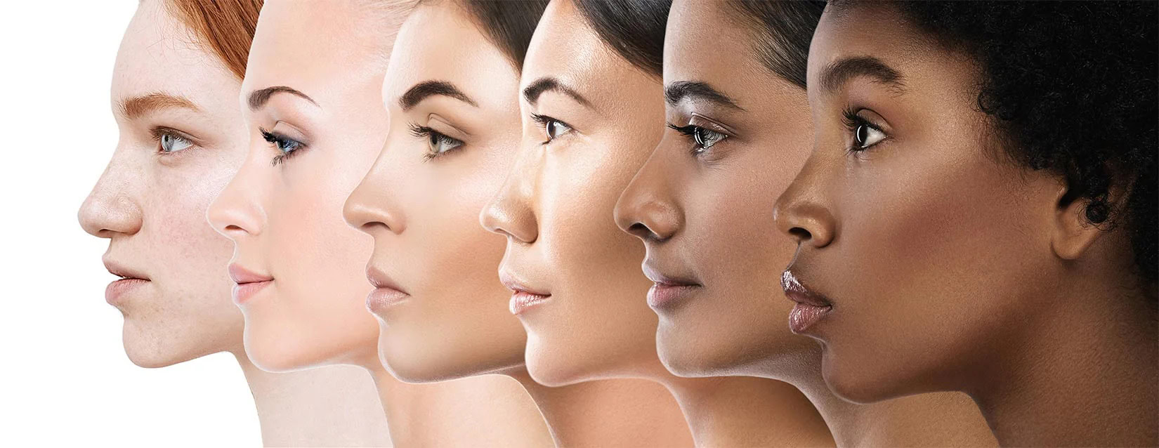 The Fitzpatrick Scale