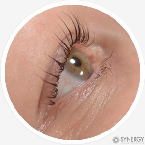 Лифтинг ресниц Лифтинг ресниц