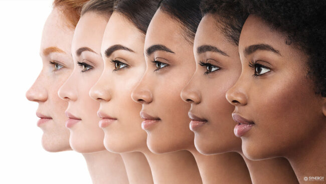 Шкала Фитцпатрика