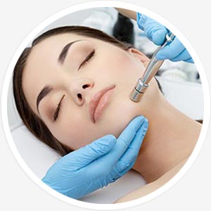 Diamant-Peeling Diamant-Peeling