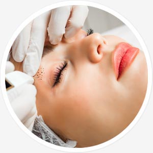 Plasma-Pen Therapie Plasma-Pen Therapie